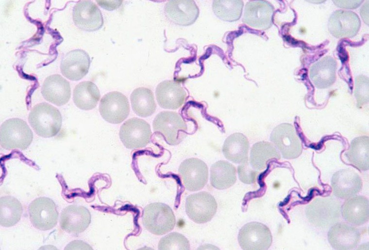 Trypanosoma-evansi-rat-blood-Giemsa-stain